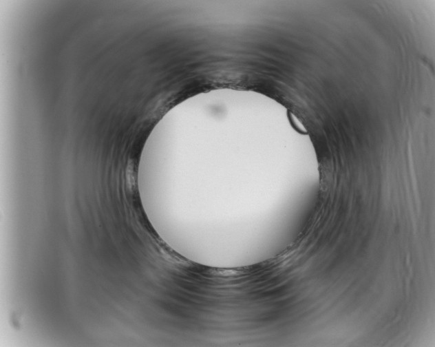 X0000099310287200805020738