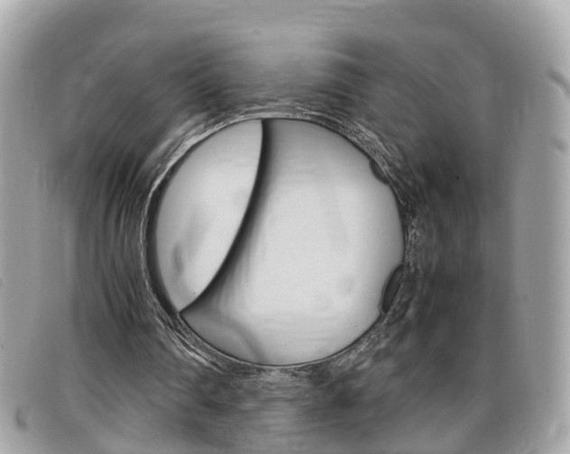 X0000099310290200805020738