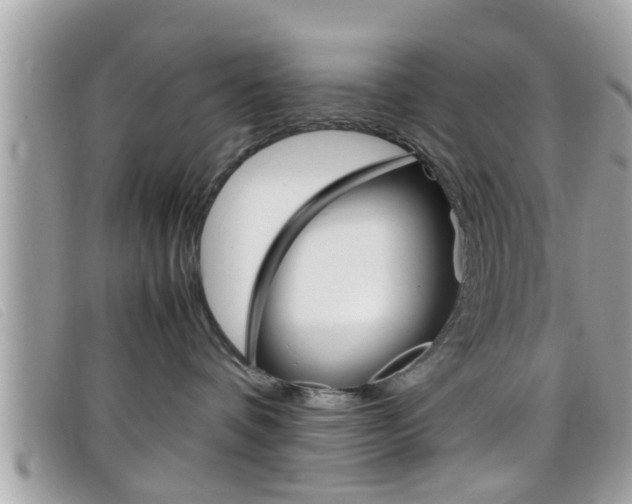 X0000099310336200805020737