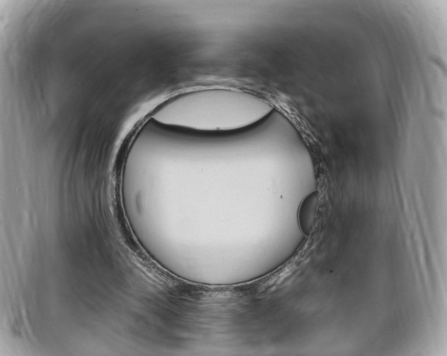 X0000099310342200805020736