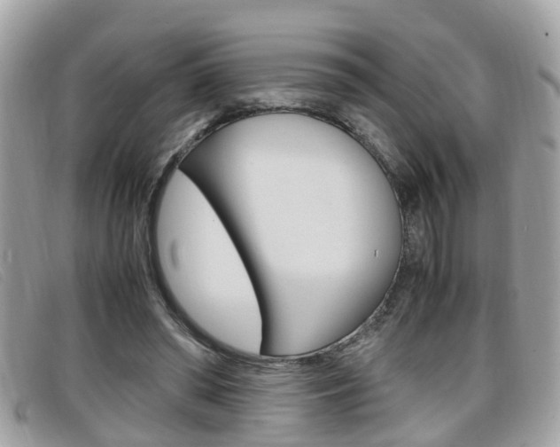 X0000099310398200805020736