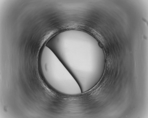 X0000099310578200805020734