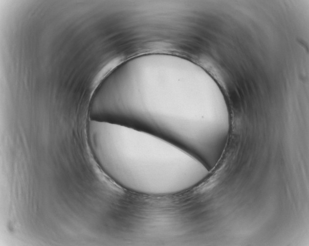 X0000099310954200805020729