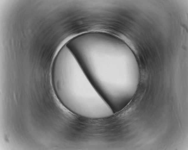 X0000099310955200805020729