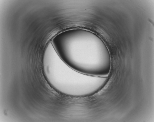 X0000099310977200805020728