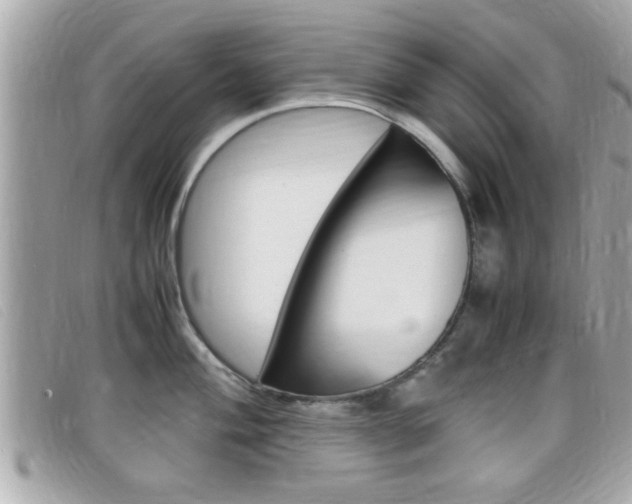 X0000099311004200805020728