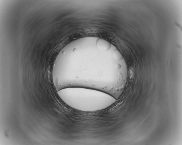 X0000099311011200805020727