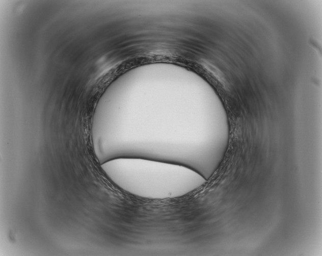 X0000099311015200805020727