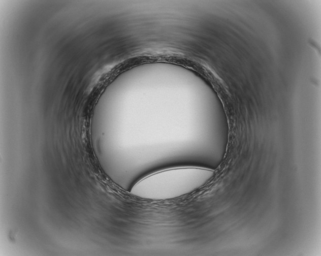 X0000099311016200805020727