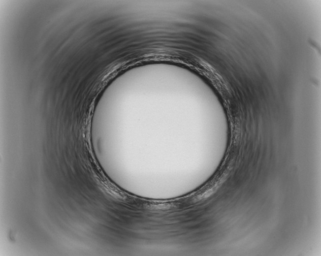 X0000099311017200805020727