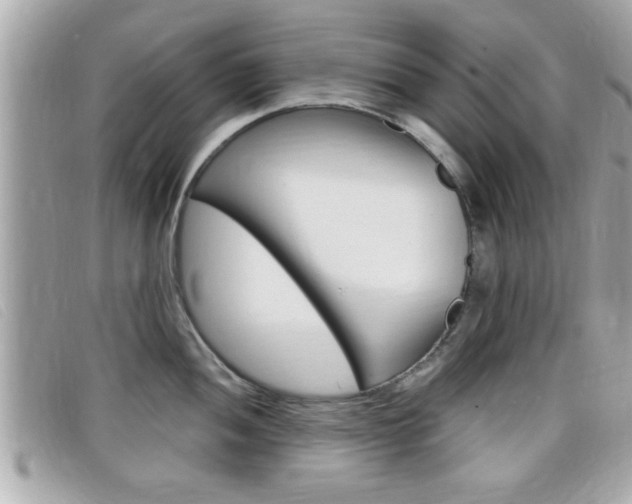 X0000099311052200805020728