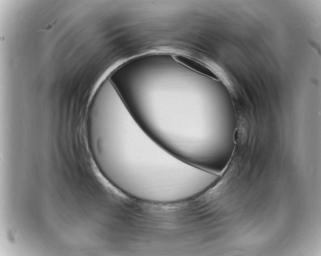 X0000099311100200805020727