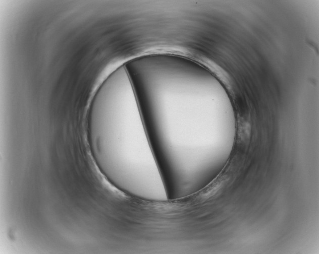 X0000099311102200805020727