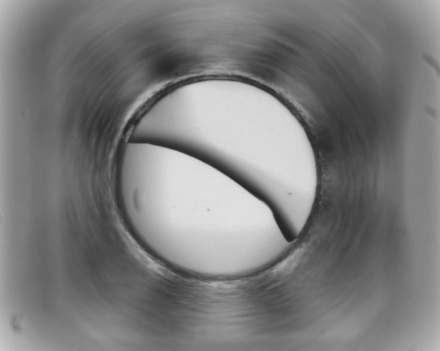 X0000099311126200805020726