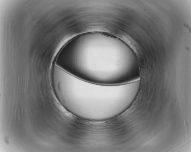 X0000099311140200805020726