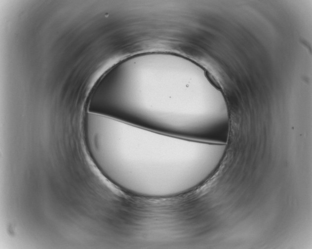 X0000099311142200805020726