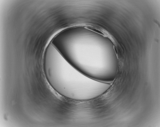 X0000099311148200805020726