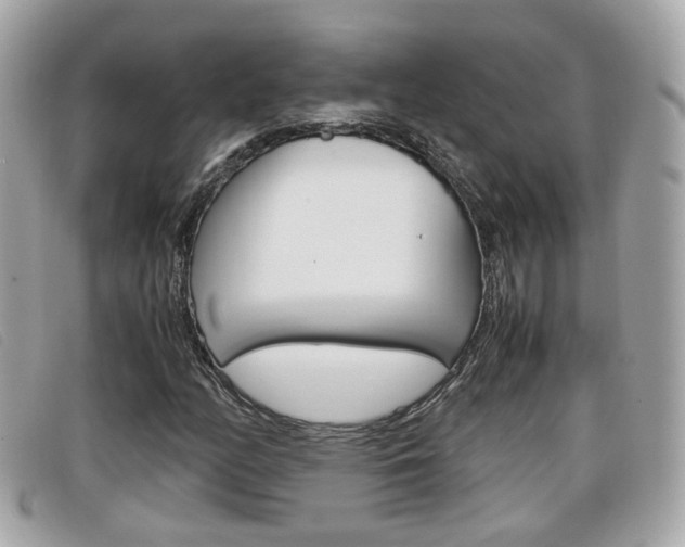 X0000099311158200805020726