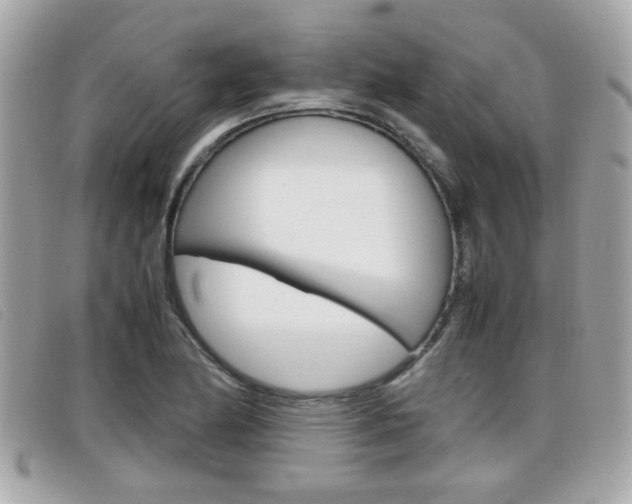 X0000099311174200805020726