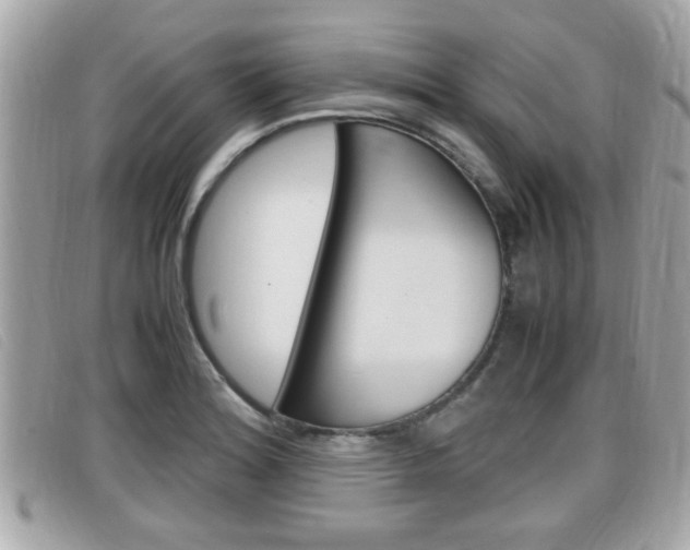 X0000099311180200805020725