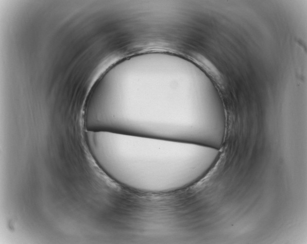 X0000099311190200805020725