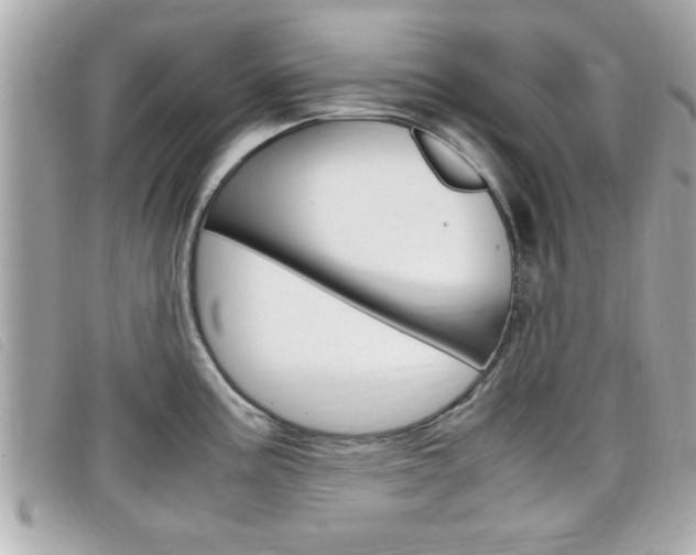 X0000099311195200805020725