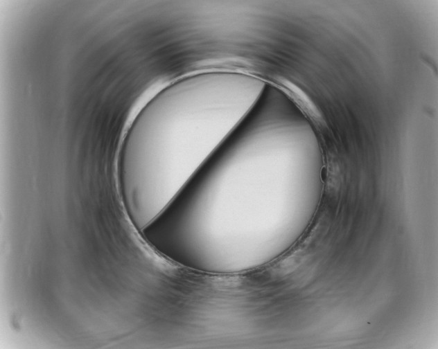 X0000099311196200805020725