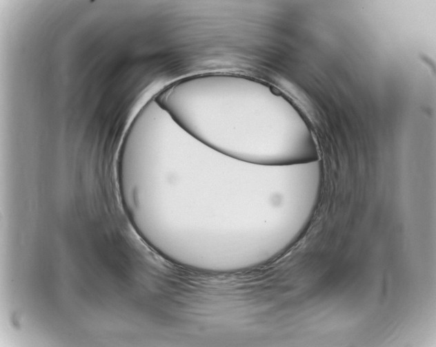 X0000099311291200805020724