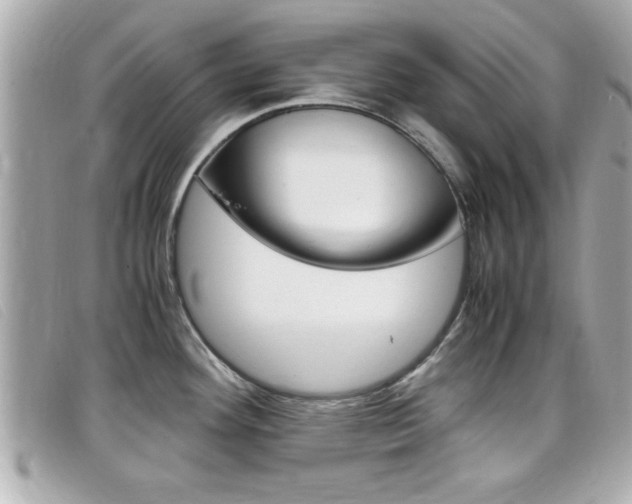 X0000099311292200805020724