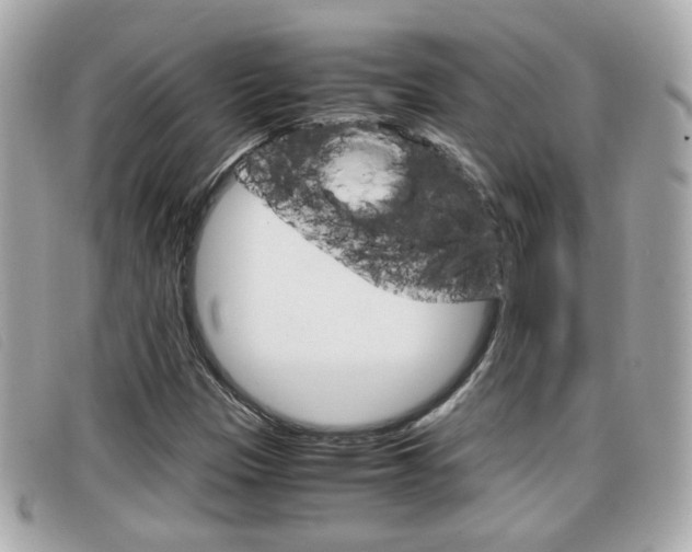 X0000099311305200805020723