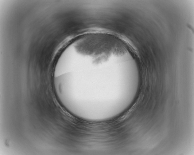 X0000099311318200805020724