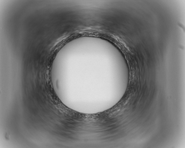 X0000099311350200805020723