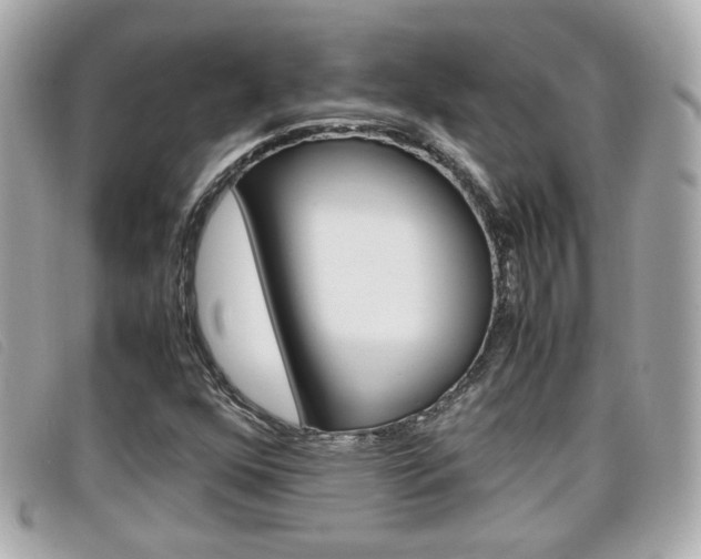 X0000099311352200805020723