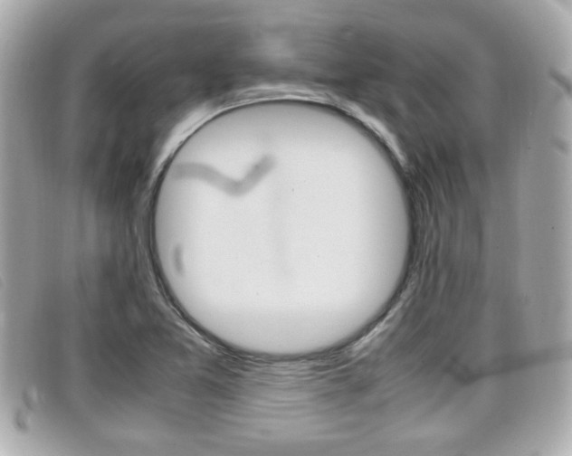 X0000099311365200805020723