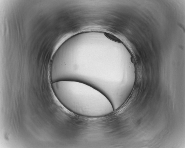 X0000099311390200805020723
