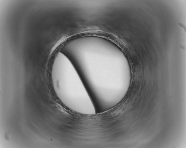 X0000099311400200805020722