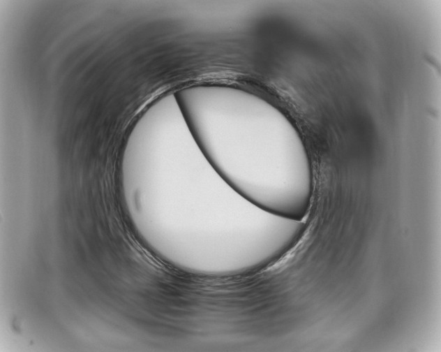 X0000099311401200805020722