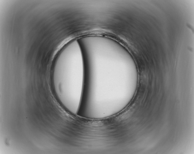 X0000099311410200805020722