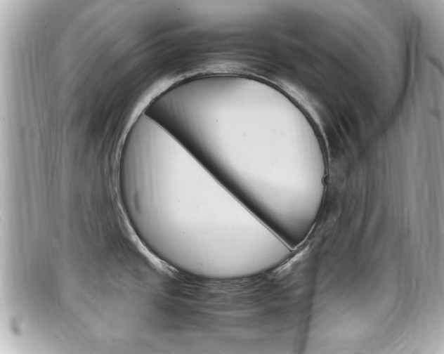X0000099311437200805020723