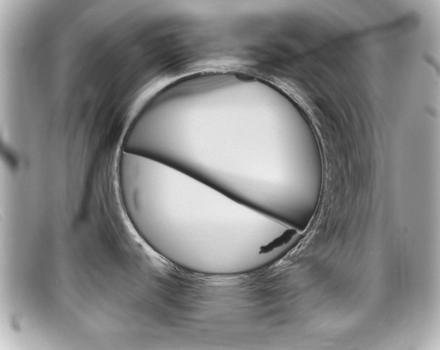 X0000099311440200805020723