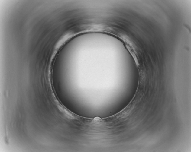 X0000099311480200805020721