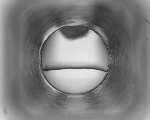 X0000099311487200805020721