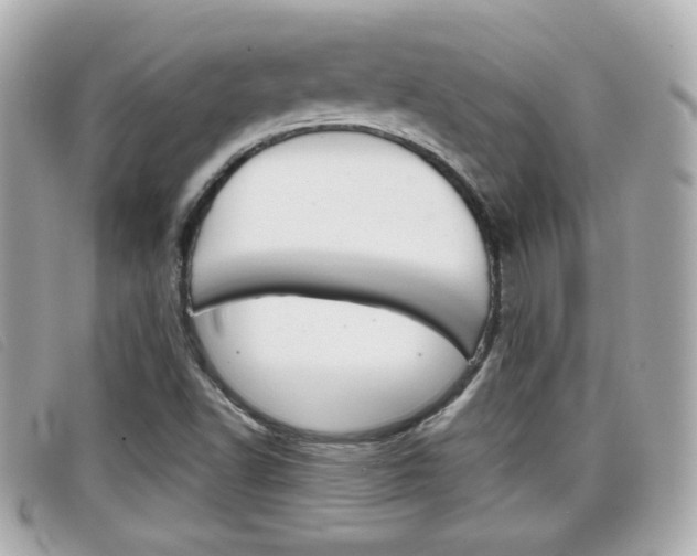 X0000099311502200805020721