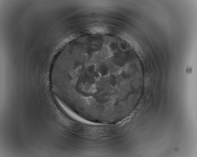 X0000099310353200805021319