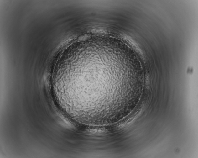 X0000099310449200805021317