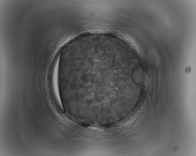 X0000099310491200805021317