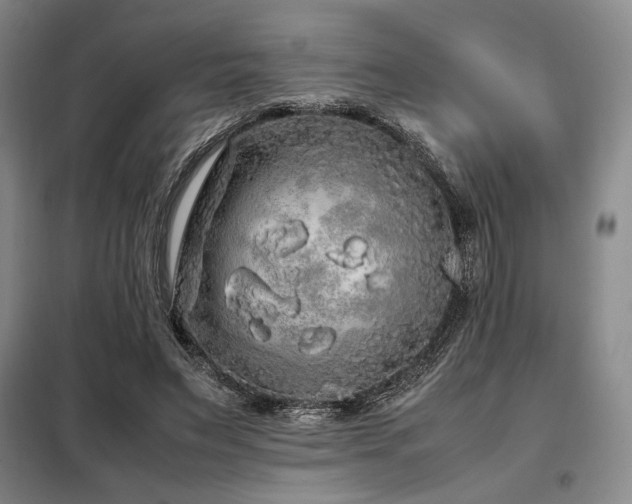 X0000099310495200805021317