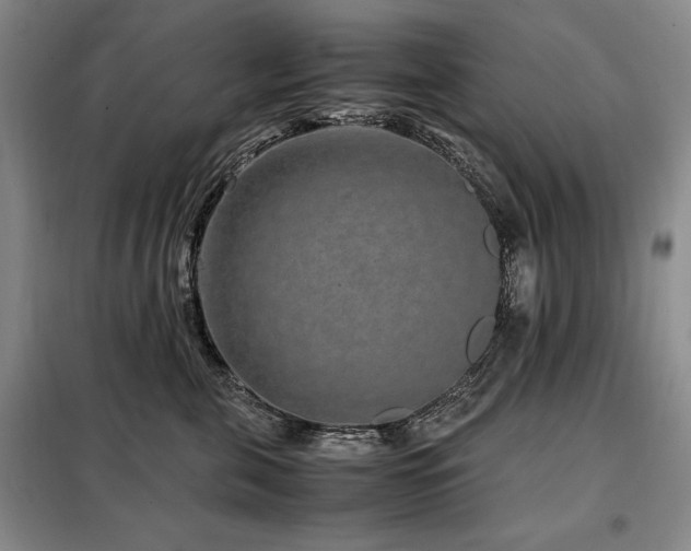 X0000099310571200805021317