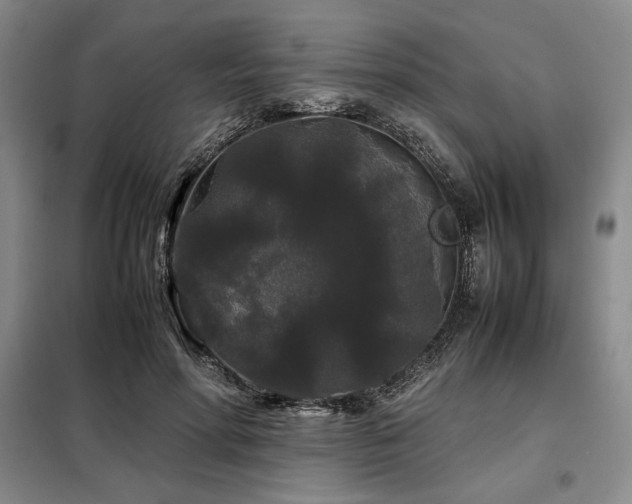 X0000099310598200805021316