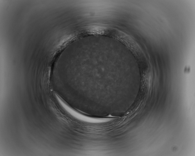X0000099310600200805021316